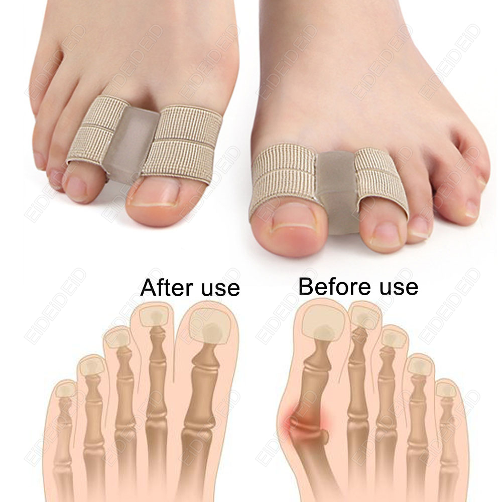 Bunion toe Corrector Orthotics - огляд і ціна Women'S Shoes For Bunions